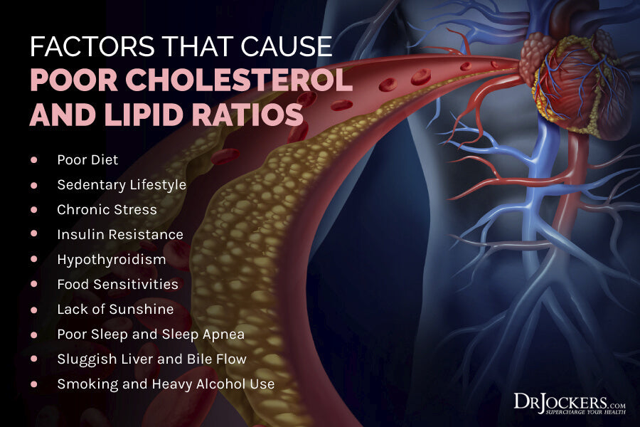 Cholesterol- The Controversial Issues, And What To Do About Yours